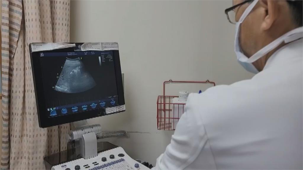 六旬男上腹痛就醫　手術取出兩千顆膽結石