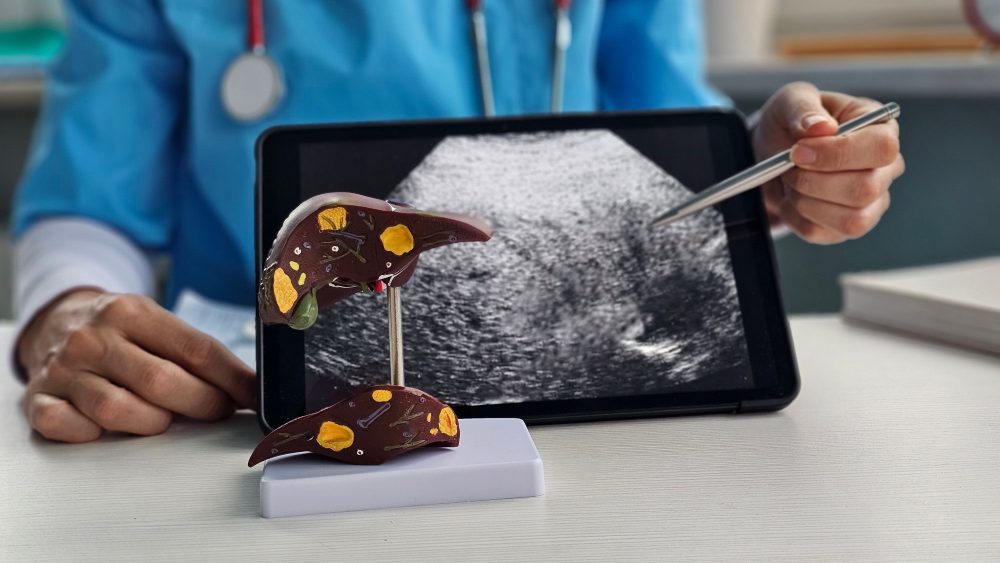 體重、BMI都正常，健檢卻驗出「脂肪肝」？  醫：「泡芙人｣快做1件事改善紅字