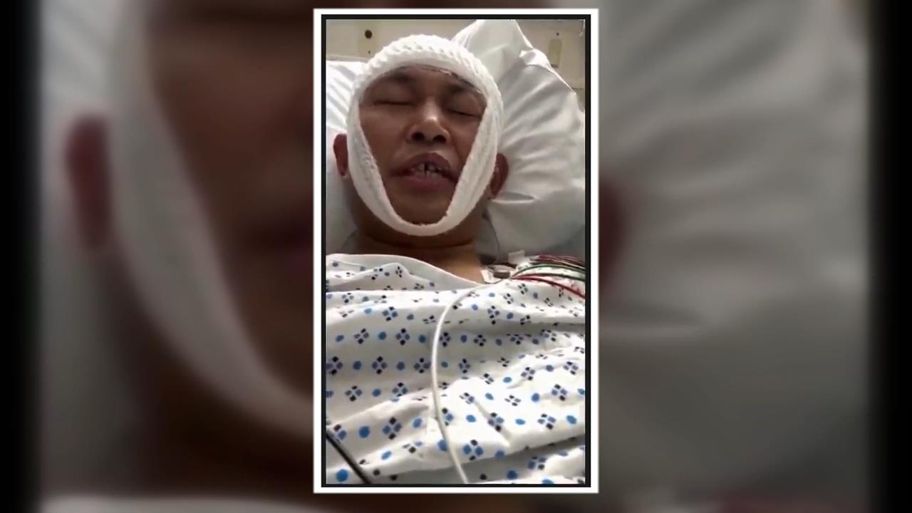 疑遭中國特務尾隨痛毆！　在美反共人士界立建重傷昏迷