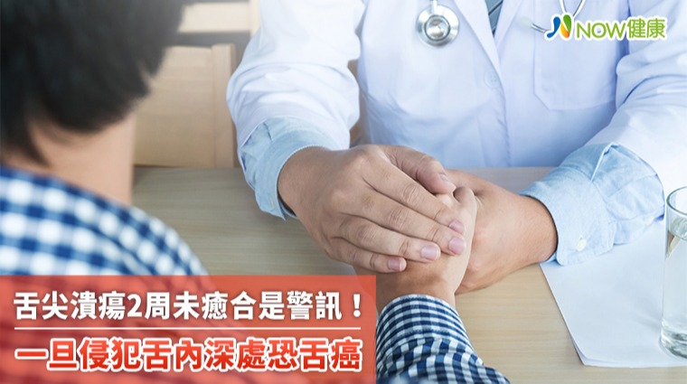 舌尖潰瘍2周未癒合是警訊！ 一旦侵犯舌內深處恐舌癌