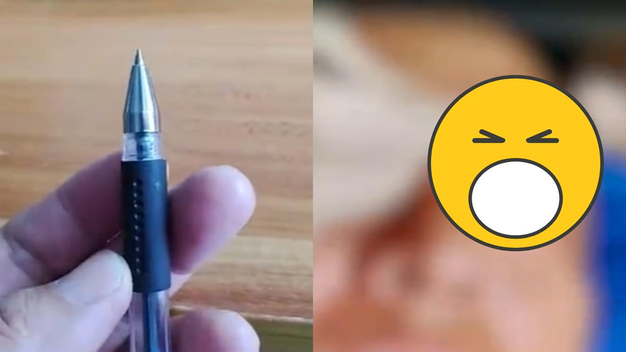 眼睛痛醫生檢查竟「挖出2.5cm原子筆頭」！他憶：27年前被同學戳過…