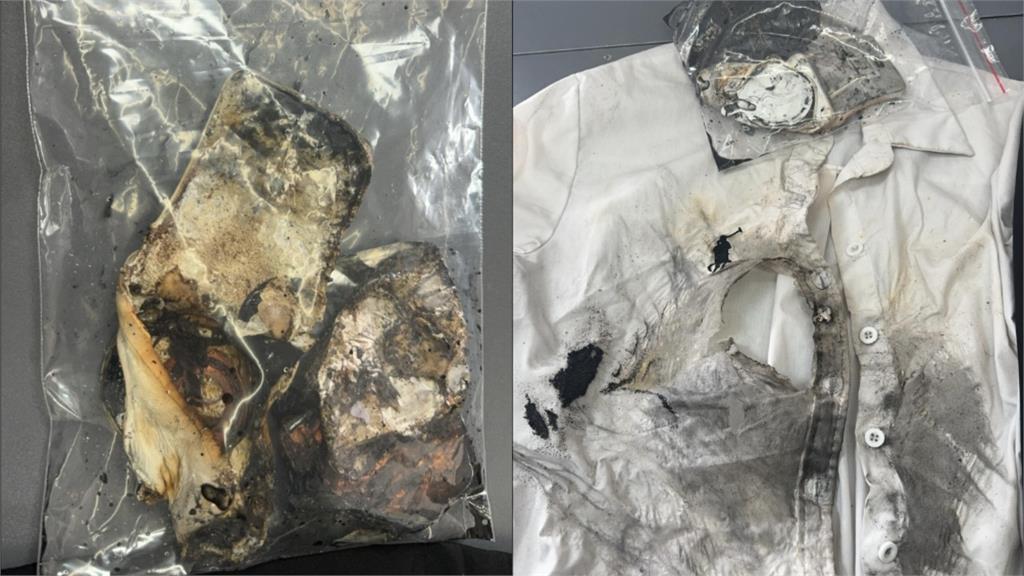 亞果磁吸爆炸燒傷臉！受害者還不只一人⋯業者回應了：建議先暫停使用
