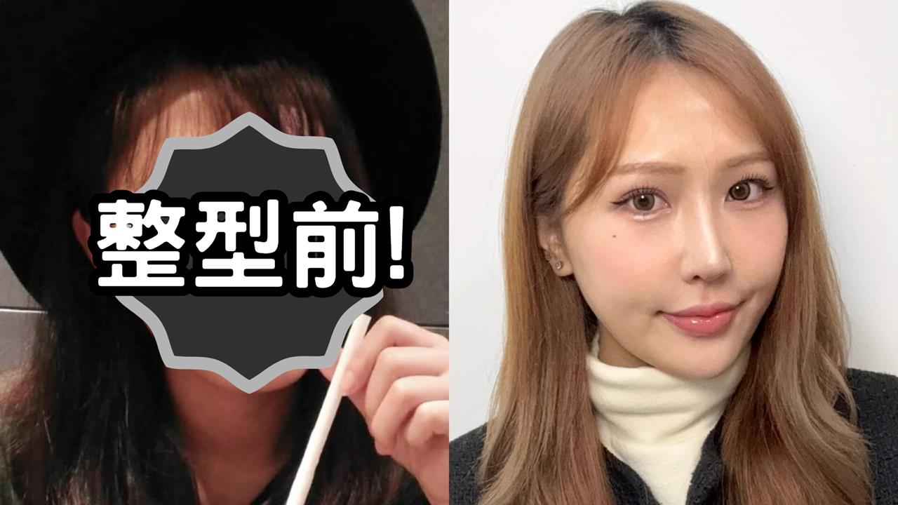 Joeman新女友「醫美前後對比照」流出…本尊霸氣:要說我整形臉都沒差!