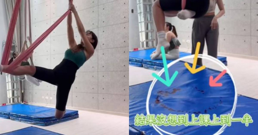 資生堂千金切5塊肚皮！練舞一半傷口撕裂　「現場大噴血」畫面超驚悚