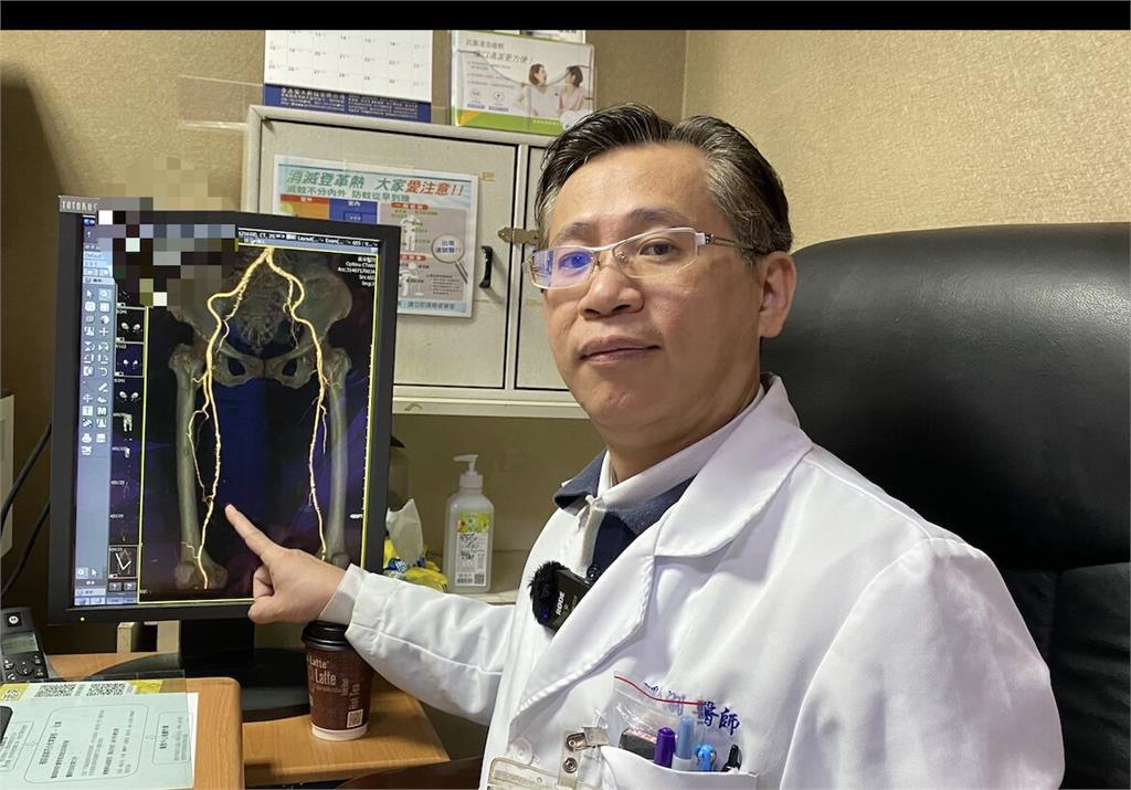 車禍小腿破皮竟惡化「爛到幾乎見骨」   傷口不癒元凶藏在血管