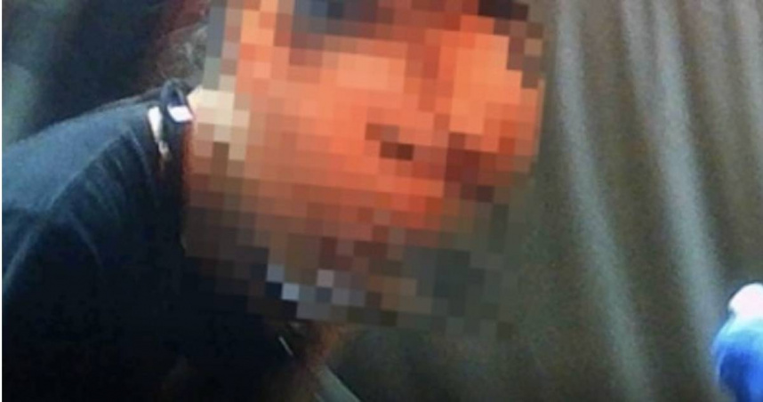 臘腸犬突襲飼主額頭撕裂！　嘉義女子家中慘遭愛犬咬傷