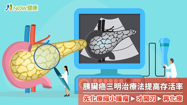 胰臟癌三明治療法新趨勢 先化療縮小腫瘤才開刀再化療