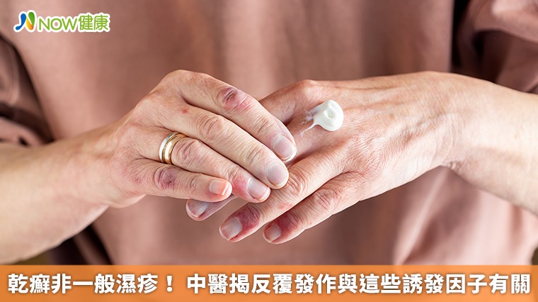 乾癬非一般濕疹！ 中醫揭反覆發作與這些誘發因子有關