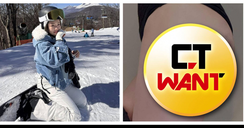 女星極樂日本發生意外!她脫褲秀「美臀大片瘀血」 雪地爆哭還原真相