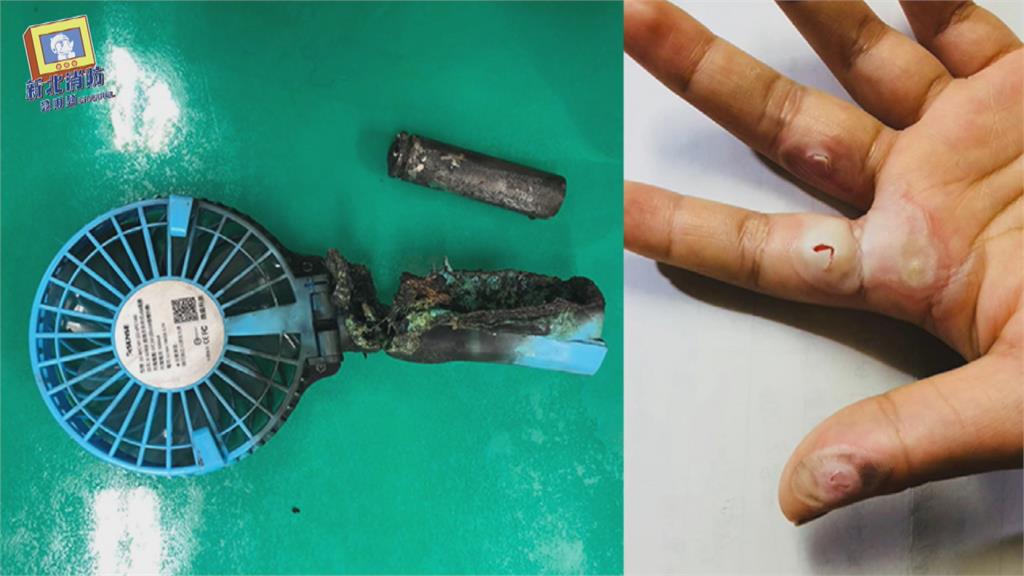 行動電風扇鋰電池突爆炸　學生手掌遭燒燙傷
