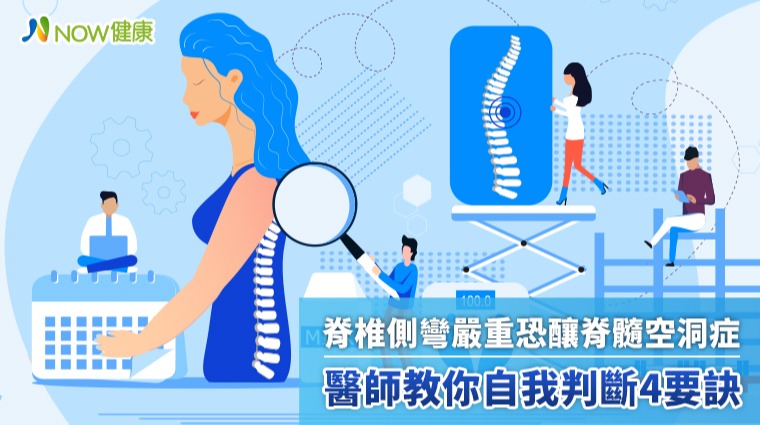 脊椎側彎嚴重恐釀脊髓空洞症 醫師教你自我判斷4要訣
