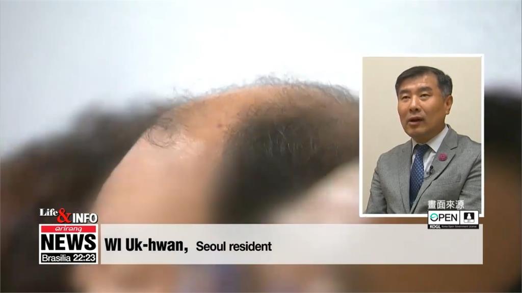 新型文明病？南韓千萬人受「脫髮」之苦