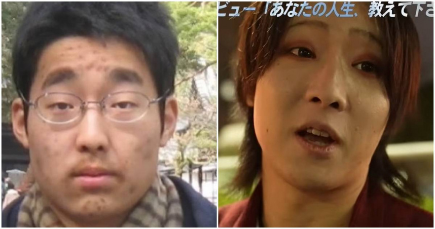 討厭照鏡子！內向痘疤男曾被女生霸凌　如今變花美男Coser