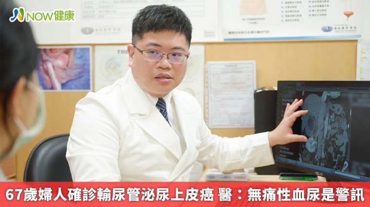 67歲婦人確診輸尿管泌尿上皮癌 醫:無痛性血尿是警訊