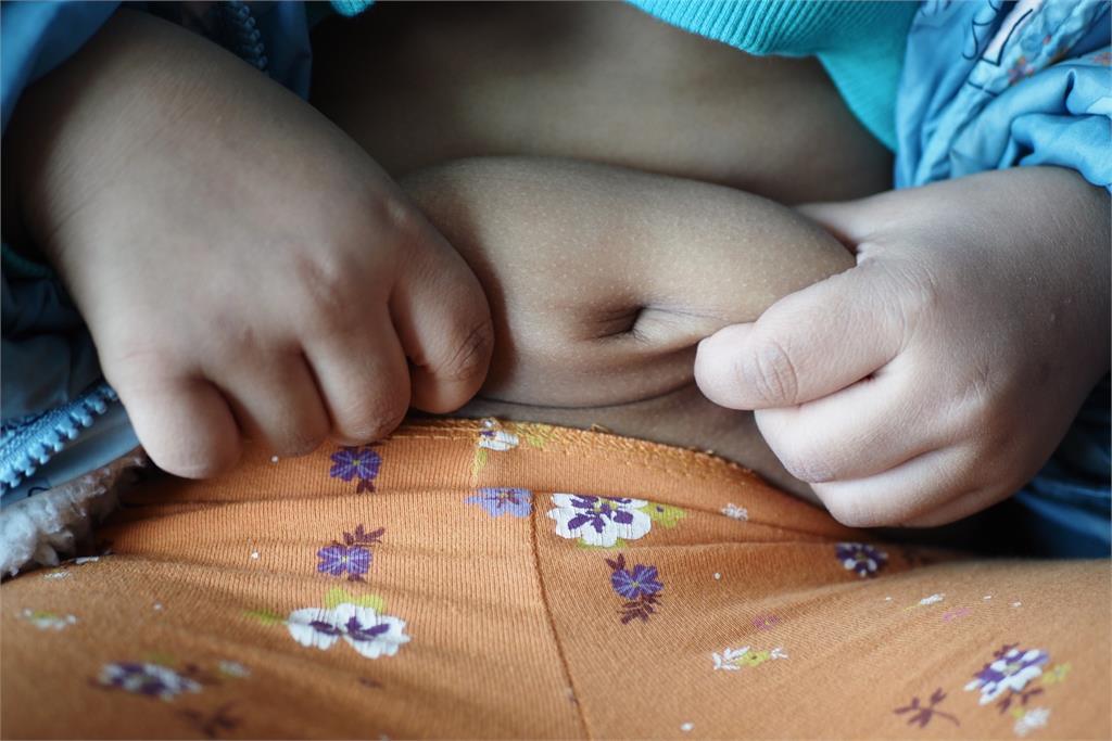 小時胖不是胖？小心一路胖到大！「兒童5肥胖原因」一次看，醫揭「4招」帶孩子遠離肥胖！