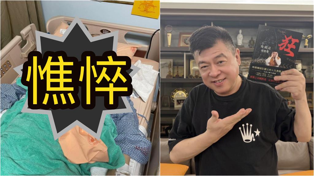 才爆「3億遺產全分好」孫德榮突開刀!插管病榻照流出「整尊憔悴」揭病況