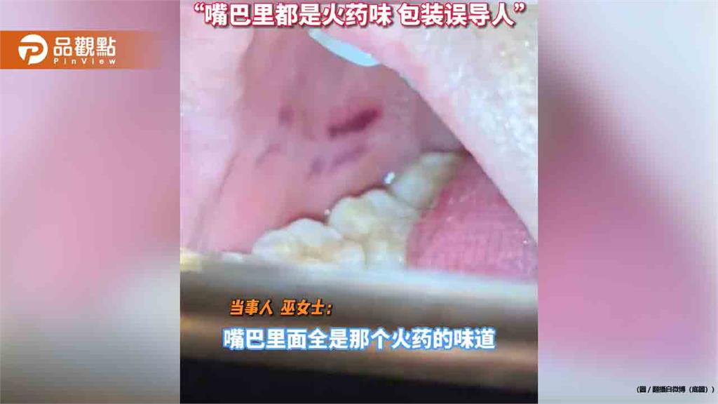 她誤把甩炮當成牛奶糖！放出口中下秒爆炸