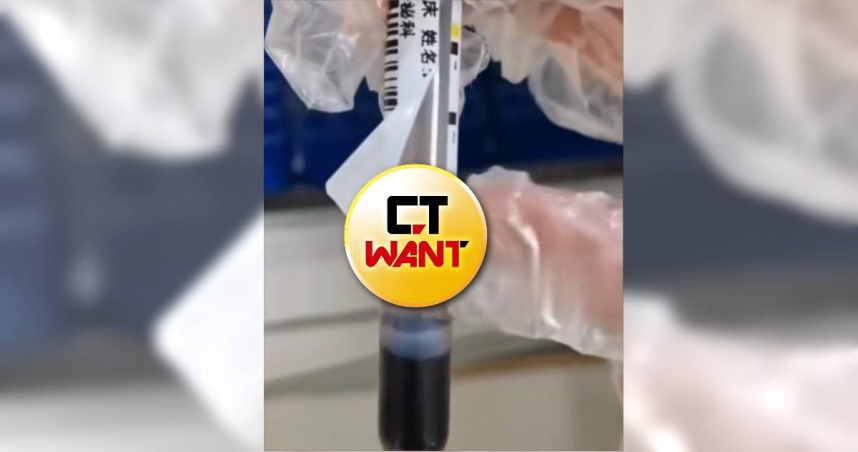 33歲孕婦胃口太好！狂嗑火鍋燒烤隔天慘了　醫抽血驚見「草莓奶昔」