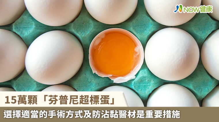 15萬顆「芬普尼超標蛋」流向全聯、楓康等10縣市 9品項完整名單曝光