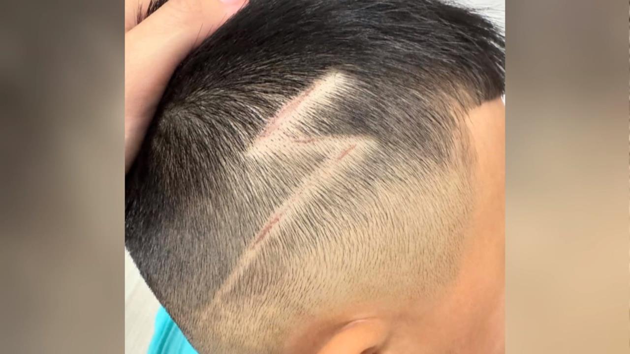5歲童理髮做"閃電刻線"剃出傷痕　業者竟回「是正常的」