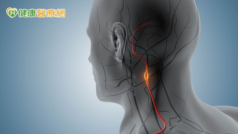 常頭暈又單側手腳發麻!醫警示:頸動脈狹窄恐釀中風風險
