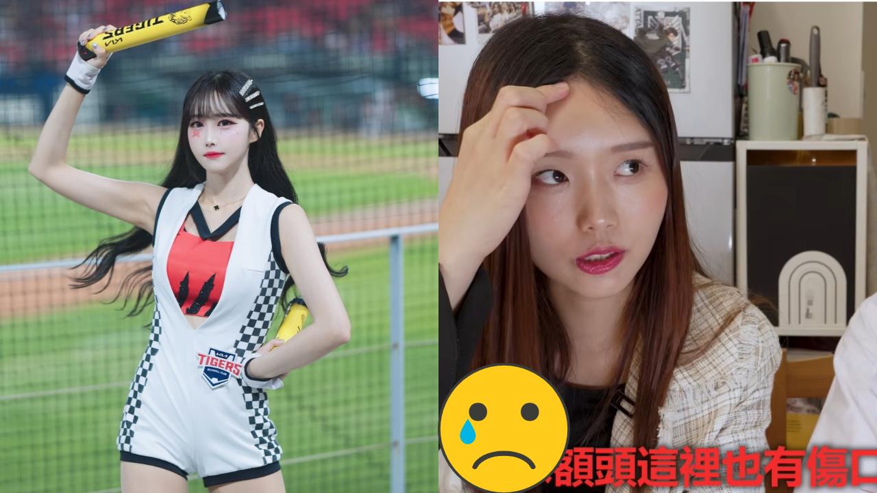 不只鄭嘉睿受壓迫！這位「啦啦隊女神」爆被同上司欺凌...流血仍逼上場