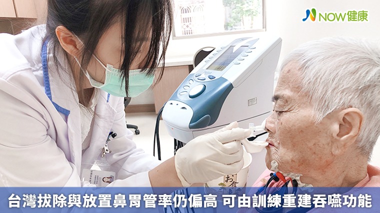 台灣拔除與放置鼻胃管率仍偏高可由訓練重建吞嚥功能 民視新聞網