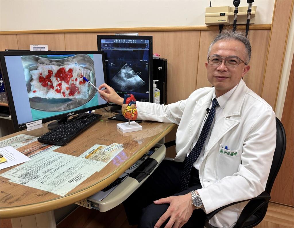 6旬婦半身癱軟 不是中風!而是心臟黏液瘤「隨心跳搖晃」