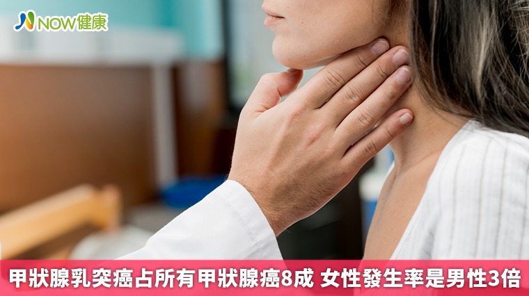 甲狀腺乳突癌占所有甲狀腺癌8成 女性發生率是男性3倍