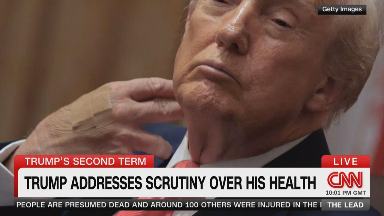 病了?川普「頸部大片紅腫」 健康狀況引關注