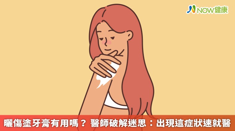 曬傷塗牙膏有用嗎？ 醫師破解迷思：出現這症狀速就醫