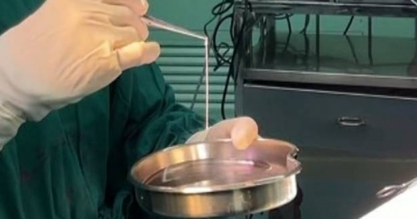 男21年不敢獨自出門!驚悚病因曝光 腦中夾出「10公分活蟲」