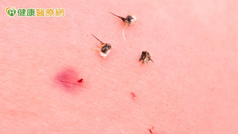 郊外踏青防蜂螫傷　「6動作」是大忌