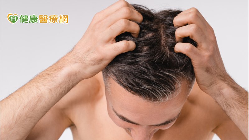 頭上出現紅皮疹以為濕疹　竟是癌前病變