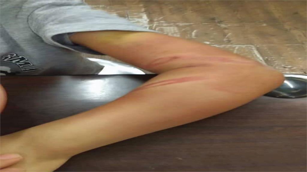 男童遭施暴不敢回家 好心業者請吃飯幫報警