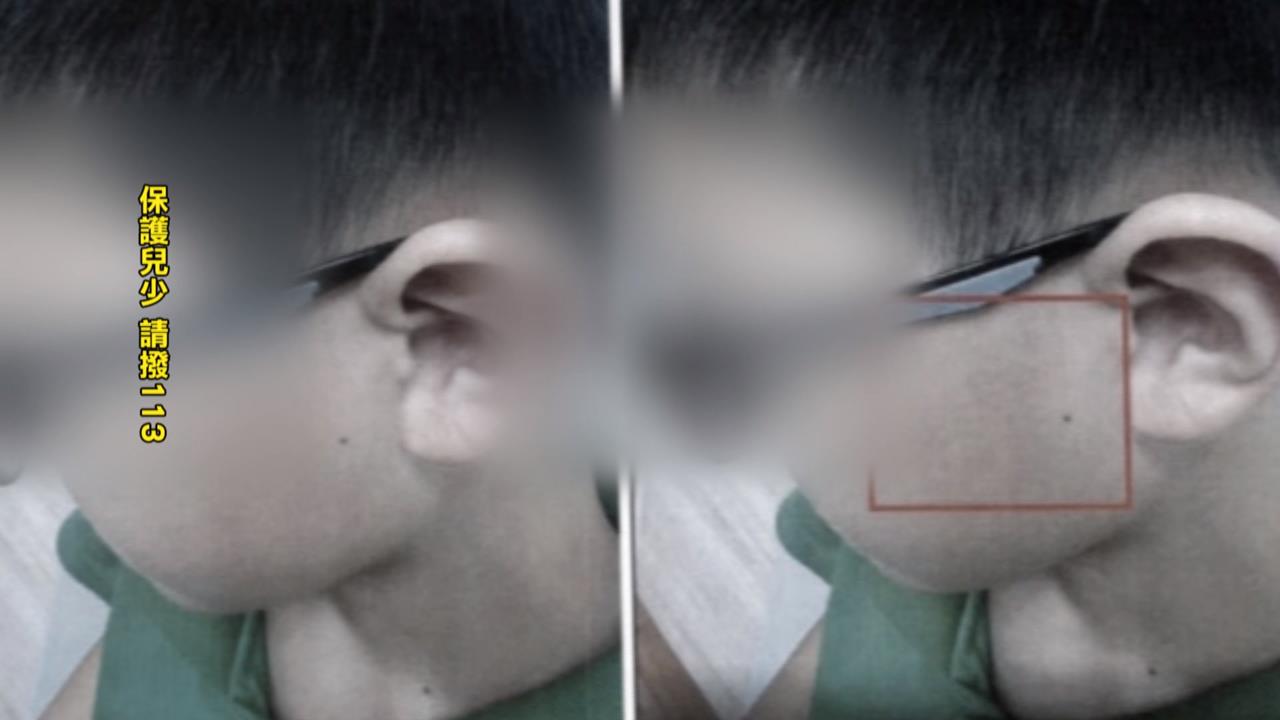 超扯！國小躲避球竟打到腦震盪？　學童曝代課老師K人「躲了會被罰」