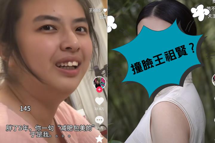 她聽友1句「瘦下來一定美」半年狂甩20公斤　 網看中國32歲女竟認錯：王祖賢？