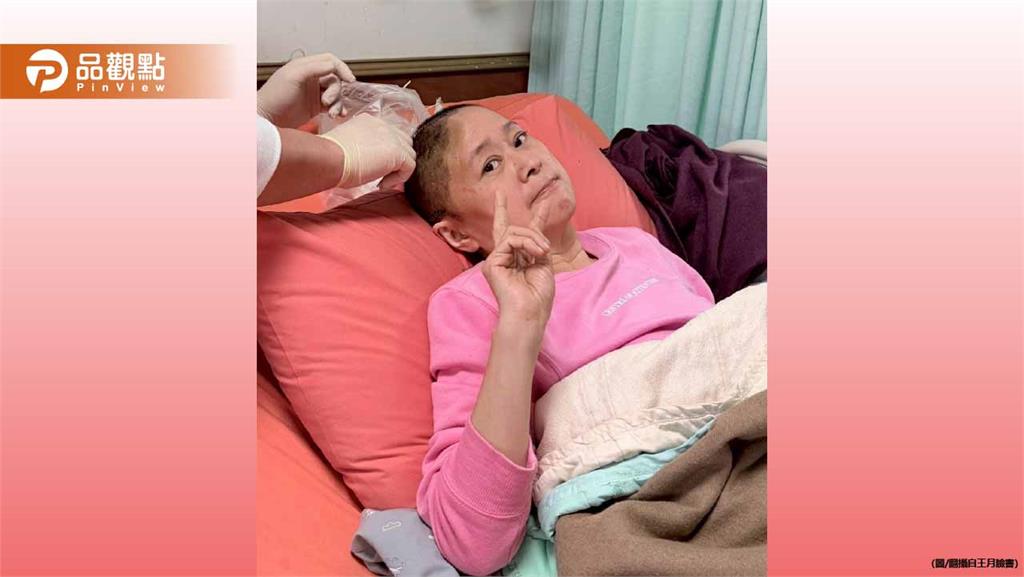 王月驚爆開顱手術！頭蓋骨缺一塊昏迷5天 淚求亡夫李國修：來接我