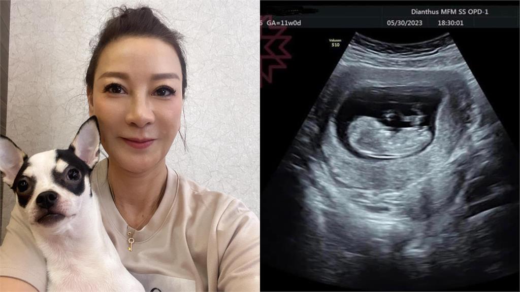 58歲楊繡惠曬超音波照！嗨喊「滿3個月再公開」網笑：爸爸是白雲？