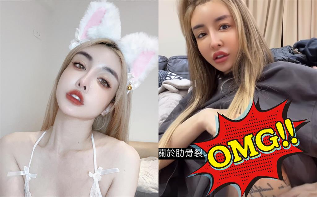 超兇教主爆意外「肋骨插內臟」狂尖叫！崩潰喊「比整型還痛」：已寫好遺囑
