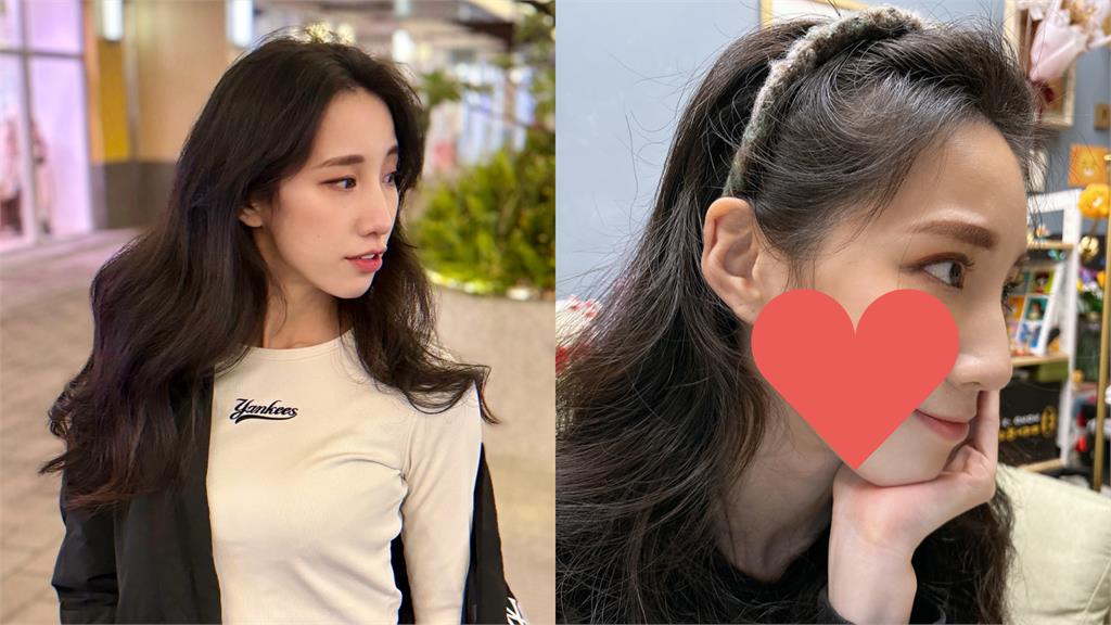 瑤瑤過年前臉毀了!突現「詭異三角形疤痕」她急求救:不知道會不會消