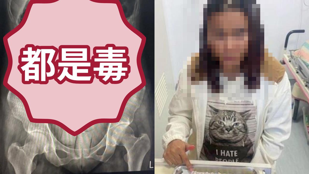 115顆海洛因「塞肛門、吞下肚」！2正妹運毒只因「想免費遊台」超慘下場曝