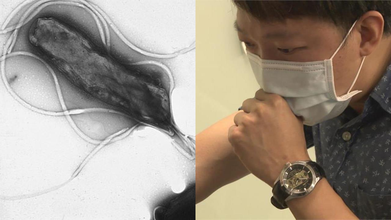 全台每2人就有1人中鏢!醫揭「隱形胃殺手」染上沒感覺⋯醫示警4類人要小心