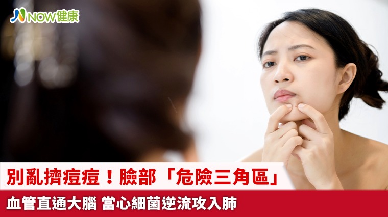 別亂擠痘痘！臉部「危險三角區」血管直通大腦 當心細菌逆流攻入肺
