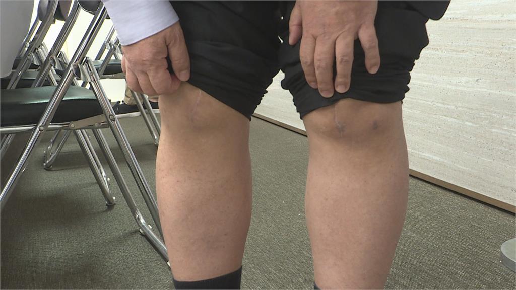 國衛院與醫療界合作　分析膝軟骨細胞治療