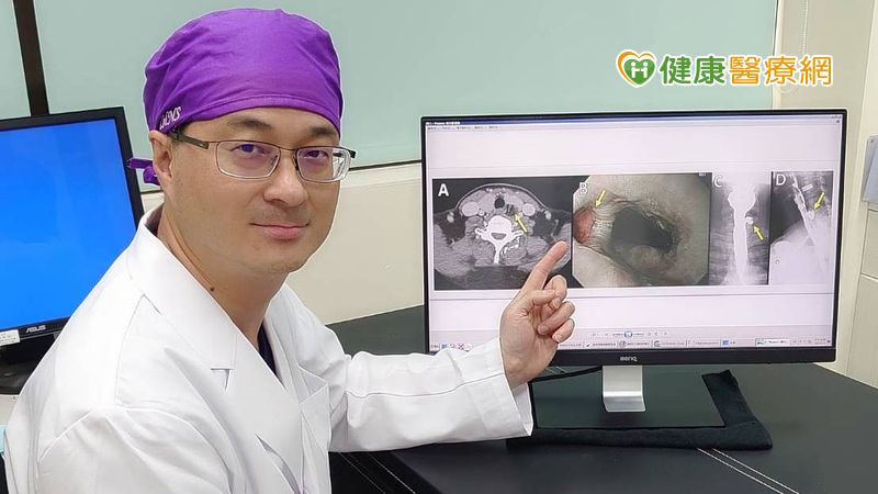 喉嚨卡卡還異常反芻　竟是食道憩室作怪