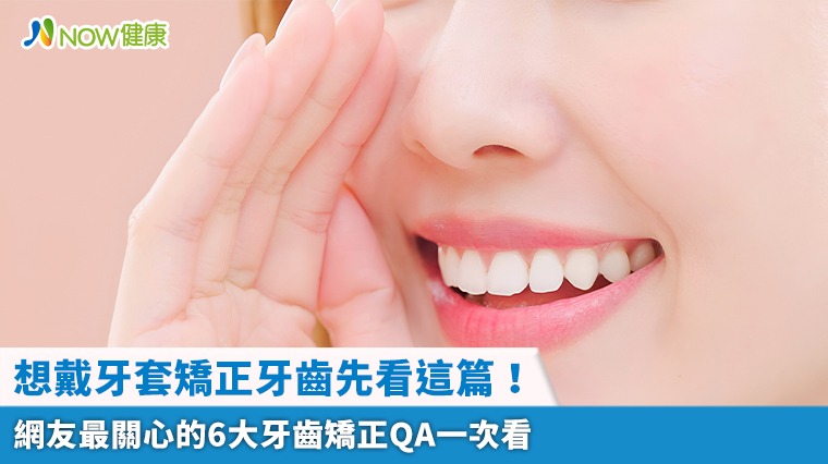 想戴牙套矯正牙齒先看這篇！ 網友最關心的6大牙齒矯正QA一次看