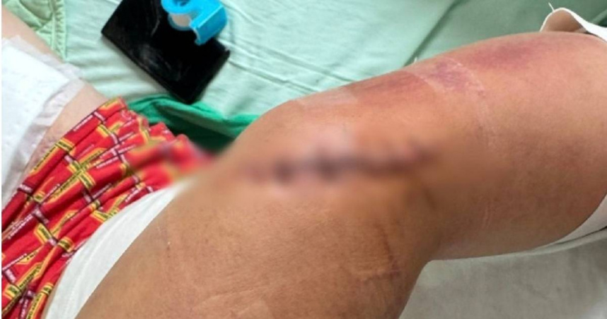 國道服務區爆砍人！男遇襲大腿驚見「12公分傷」　警全力緝兇中