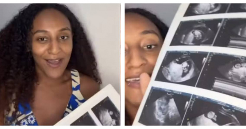 罕見「雙胎異期」案例！24歲媽媽懷孕中再受孕　一晚經歷自然產和剖腹產　