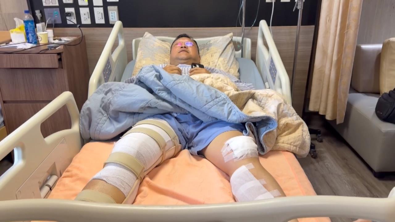 毒駕撞斷所長腿"無保請回"拎水果求原諒 家屬:無福消受